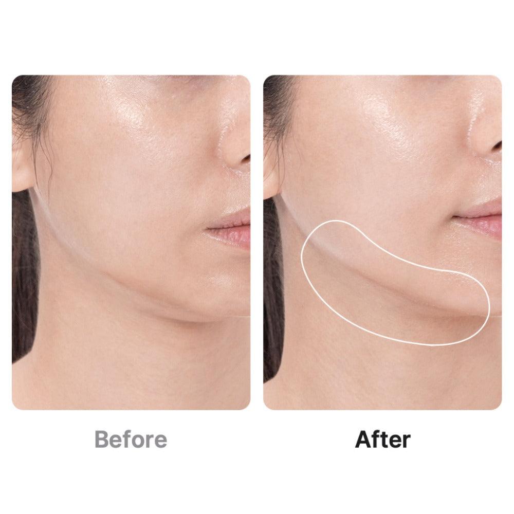 Lift, Firm & Glow — From the Comfort of Home